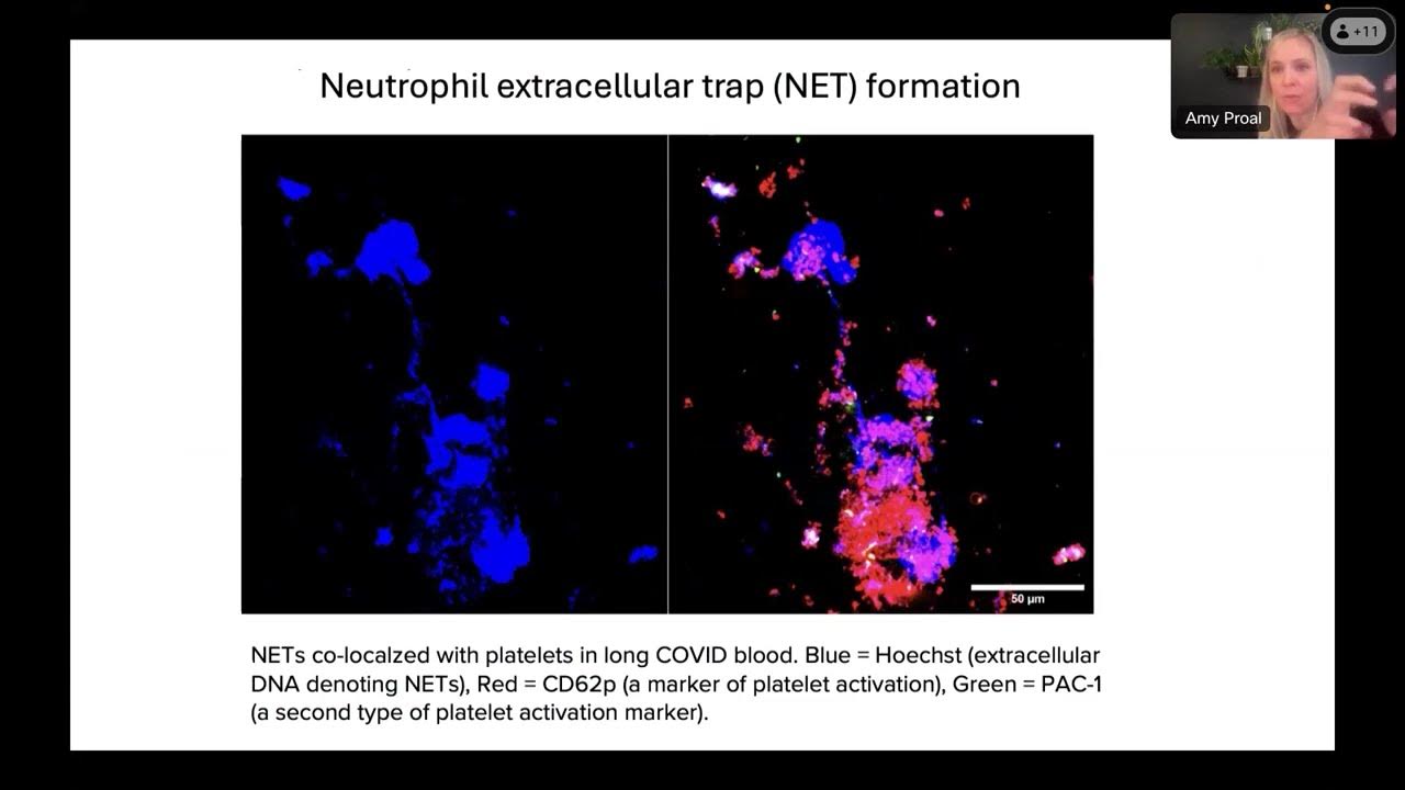 katha1970's tweet card. Dr. Amy Proal: Pathogen Persistence in Long Covid & ME/CFS (Day 1,...