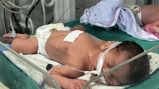 CBCNews's tweet card. After their three children were killed in an Israeli strike on their home in Gaza City last year, Diana and Omar Al-Rubai were just days away from the expected arrival of their baby when they were...