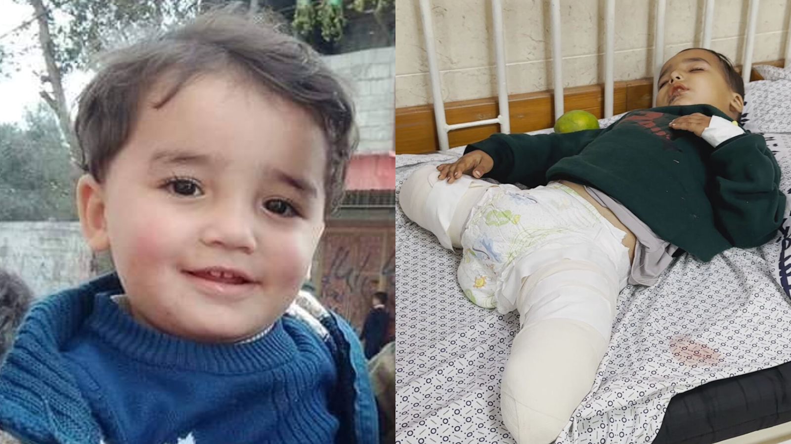 rachyoungeritv's tweet card. ITV News travelled with three-year-old Ahmad from Egypt to Italy for hospital treatment, as his uncle shared the child's tragic experience of the war in Gaza. | ITV National News