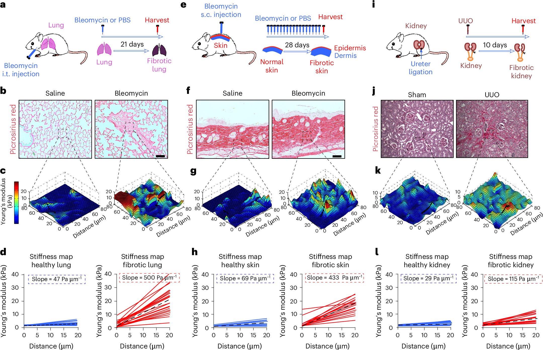 AdamEnglerUCSD's tweet card. Nature Cell Biology - Al-Hilal, Chrysovergi et al. identify a role for durotaxis in lung fibrosis and metastatic pancreatic cancer, mediated by the FAK–paxillin mechanosensor complex, and...