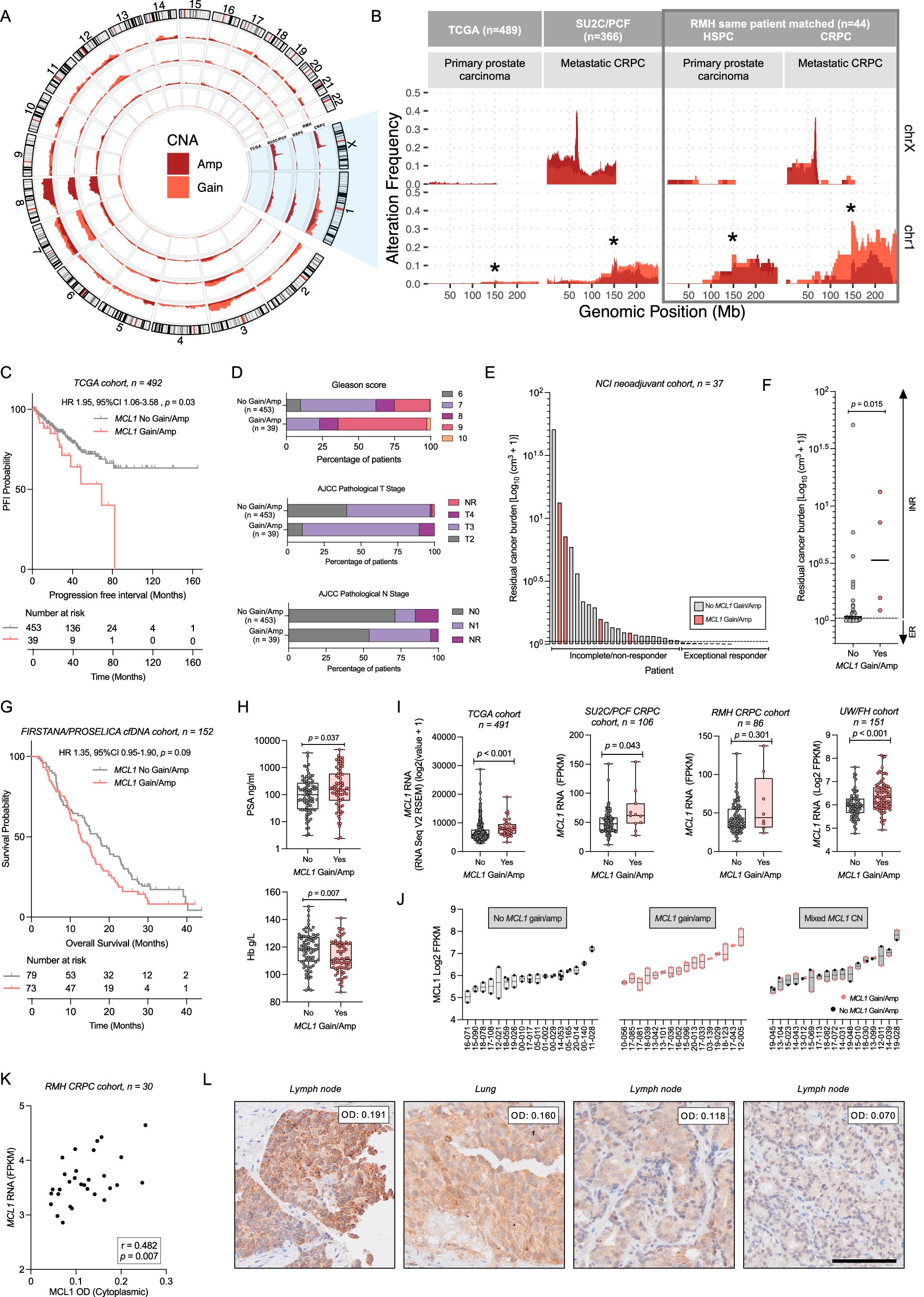 AdamSharpMedOnc's tweet card. Nature Communications - Despite improving therapeutic options, the prognosis for patients with metastatic castration-resistance prostate cancer (mCRPC) remains poor. Here, the authors identify MCL1...