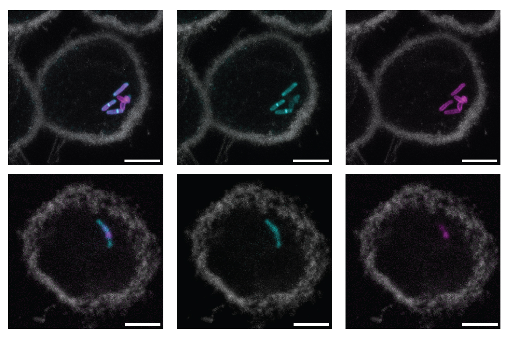 MIT's tweet card. MIT chemists found a way to identify a complex sugar molecule in the cell walls of Mycobacterium tuberculosis, the world’s deadliest pathogen. This labeling could lead to simpler, faster TB tests.