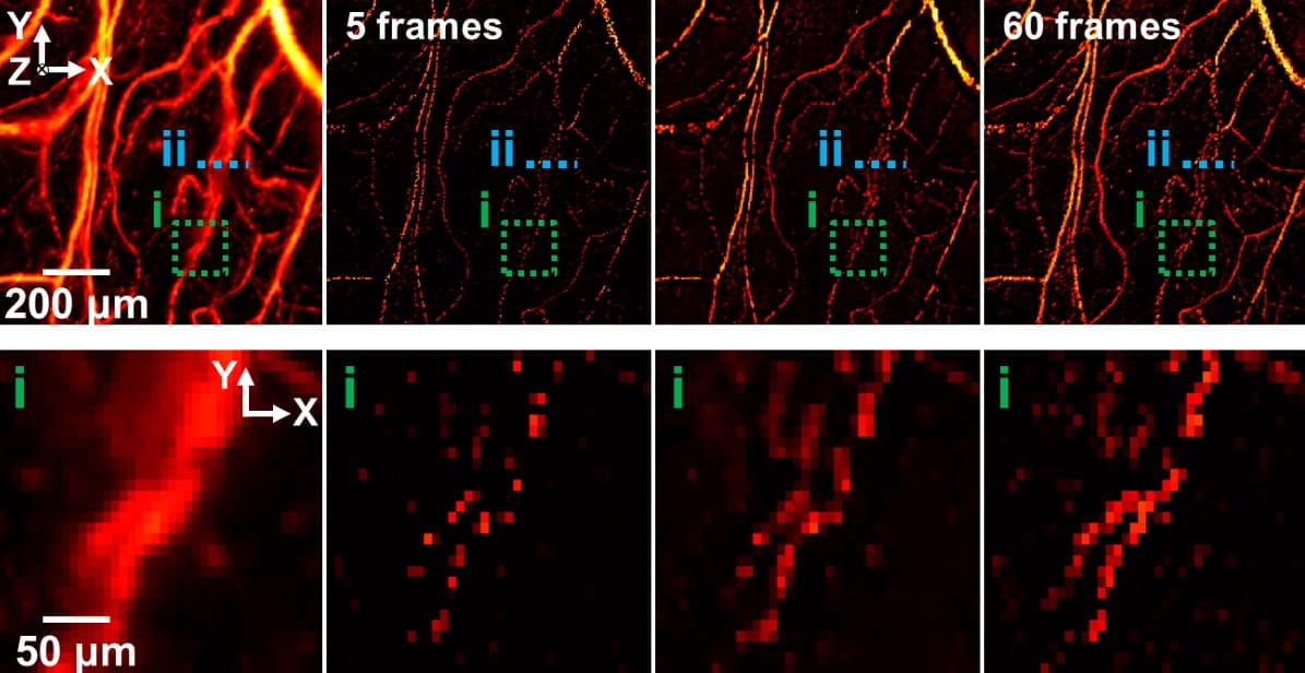 bcawareness's tweet card. Computational strategy enables high spatial and temporal resolution in both label-free photoacoustic microscopy and labelled photoacoustic tomography