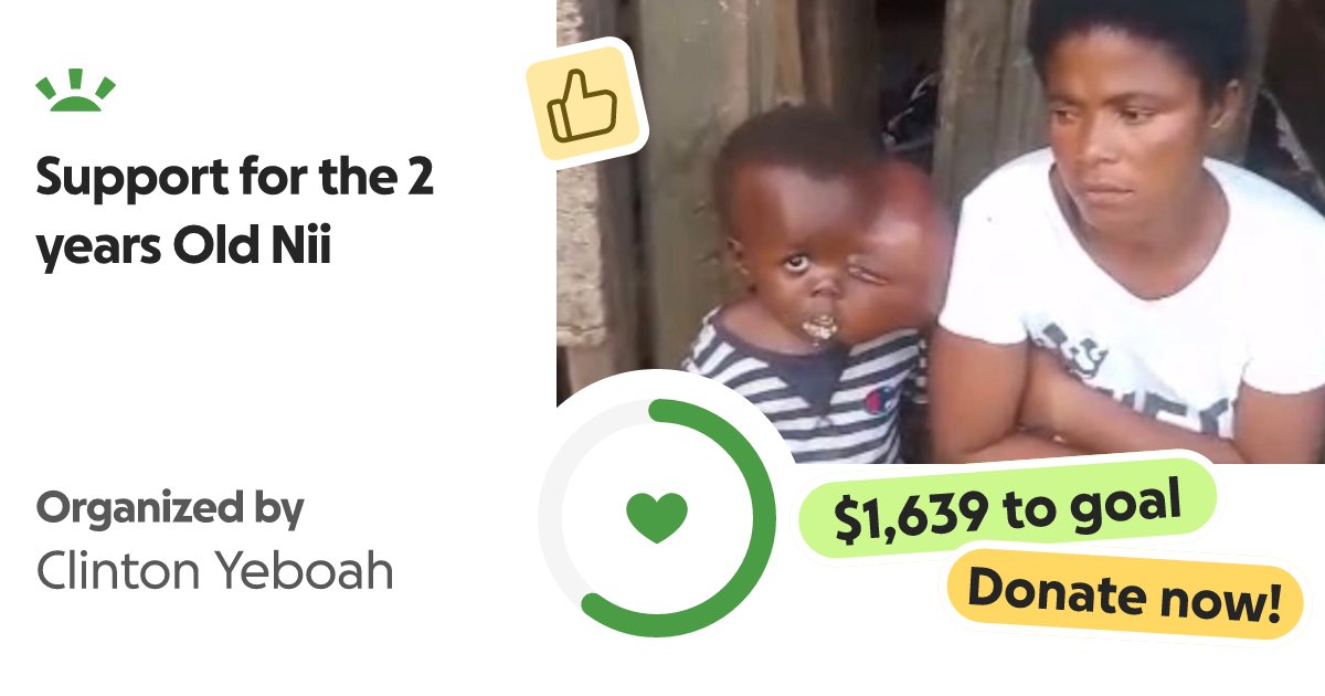 bonesmantv's tweet card. Nii is a 2 years Old boy who needs GHc50,000 to undergo his surgery. Currently, his lef… Clinton Yeboah needs your support for Support for the 2 years Old Nii