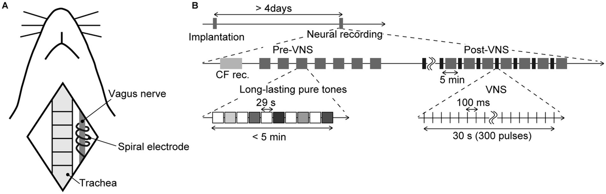 FrontNeurosci's tweet card. Understanding how vagus nerve stimulation (VNS) modulates cortical information processing is essential to developing sustainable, adaptive artificial intelli...