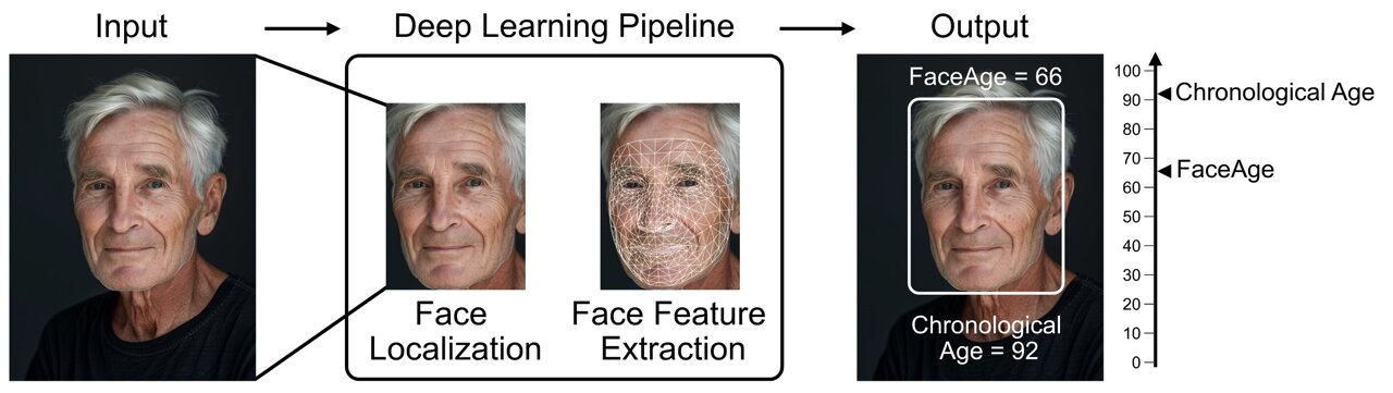 medical_xpress's tweet card. Eyes may be the window to the soul, but a person's biological age could be reflected in their facial characteristics. Investigators from Mass General Brigham developed a deep learning algorithm...