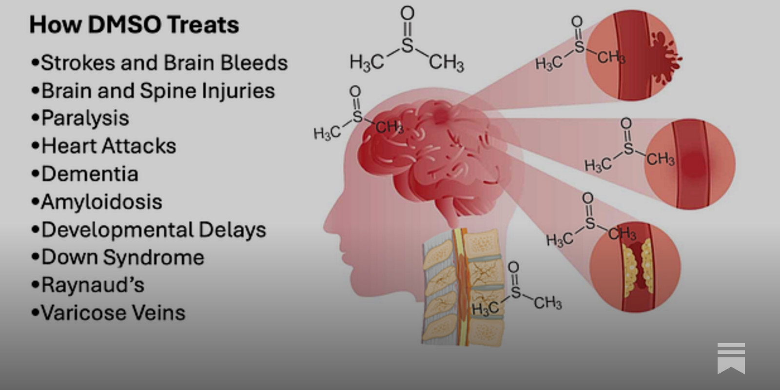 PierreKory's tweet card. The decades of evidence showing DMSO revolutionizes the care of many "untreatable" circulatory and neurologic conditions.