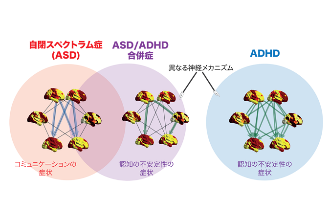 UTokyo_News's tweet card. 自閉スペクトラム症（ASD）とADHDの合併症の神経基盤 | 東京大学