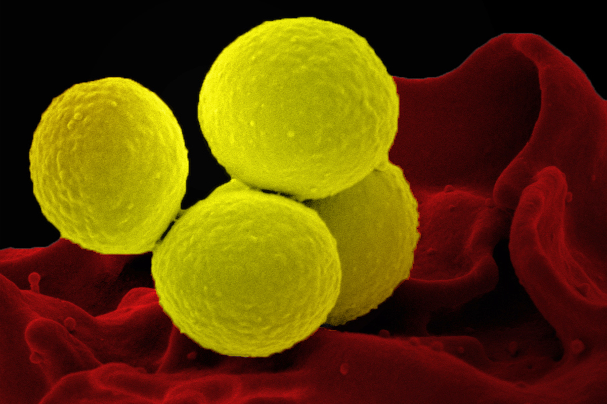 MITCSBPhD's tweet card. MIT researchers find Staphylococcus aureus can rapidly evolve within a single person’s microbiome. In people with eczema, S. aureus tends to evolve to a variant with a mutation in a specific gene...