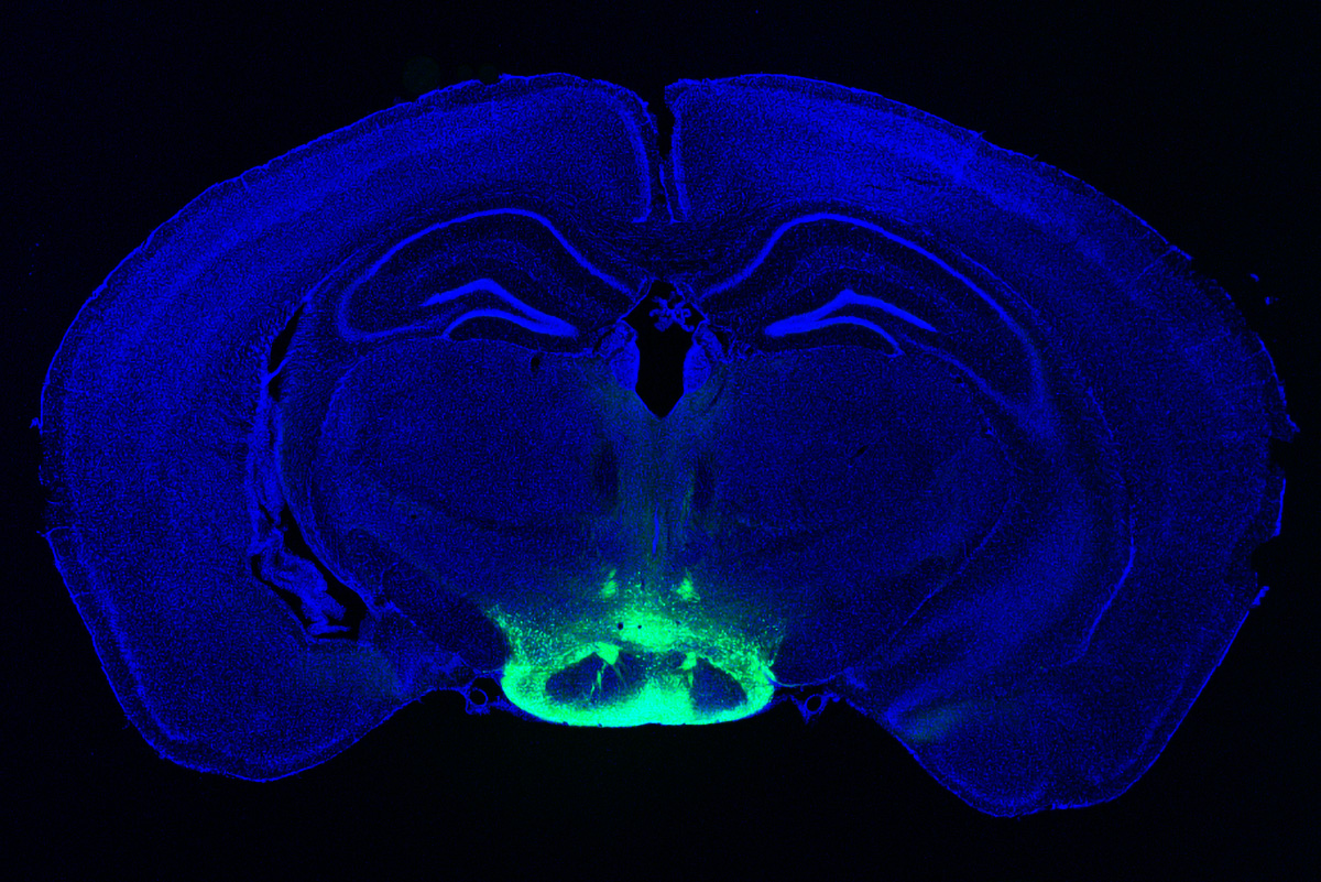 MITCSBPhD's tweet card. MIT researchers identified neurons in the brain that may contribute to some of the earliest symptoms of Alzheimer’s disease, making it a good target for potential new drugs to treat the disease.
