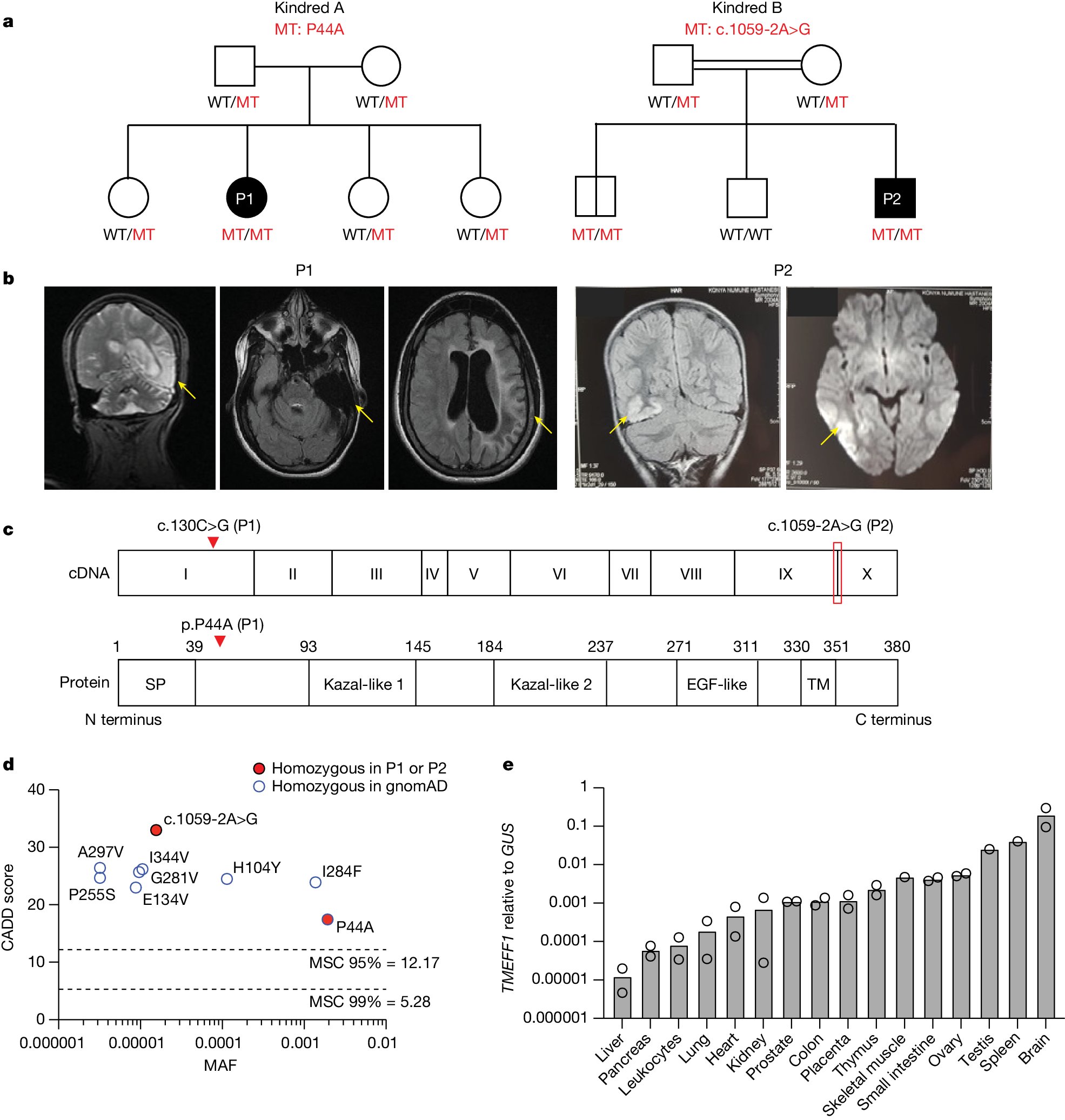 Nature's tweet card. Nature - A study of two childhood cases of herpes simplex encephalitis shows that TMEFF1 interacts with the HSV-1 cell-surface receptor NECTIN-1, preventing HSV-1 from fusing with the cell membrane...