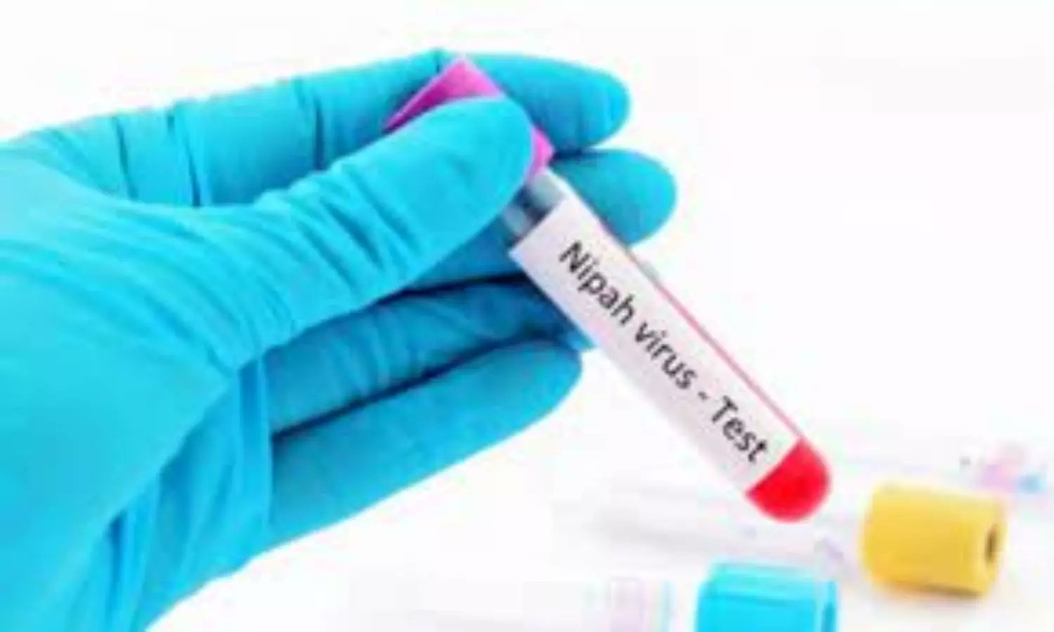 COVID19_disease's tweet card. The patient had a history of travel to Nipah affected areas in Kerala and the symptoms of Encephalitis have been reported to be indicative of Nipah.
