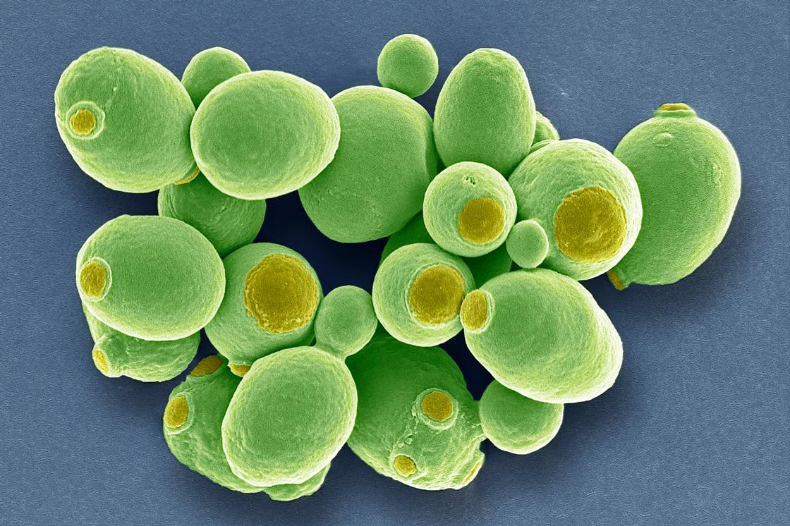 CrowdedHead's tweet card. Condensate formation is central to how budding yeast cells decide their response to environmental and internal conditions