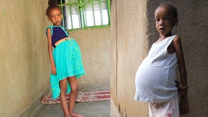catnip55's tweet card. This young little girl Olga is suffering from congestive heart failure and this disea… Private Ineza needs your support for Help Her to get advanced treatment