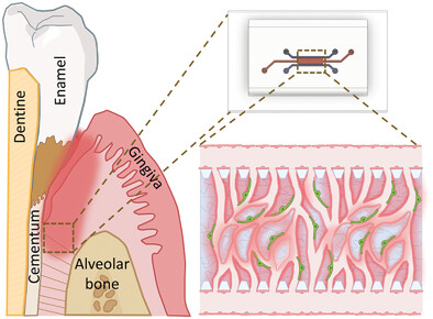BioanalyticsLab's tweet card. Teeth are crucial for oral health and well-being. Periodontal infections like periodontitis often result in tooth loss. Addressing the lack of effective in vitro models, a microfluidic model of the...