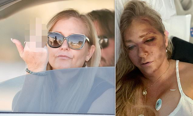 drpiotrowski's tweet card. It's the first time Virginia Giuffre has been spotted in public since being involved in what police called a minor bus crash north of Perth.