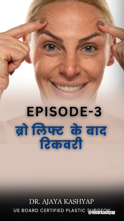 Drajayakashyap's tweet card. ब्रो लिफ्ट के बाद रिकवरी #browlift #ep3 #ytshorts