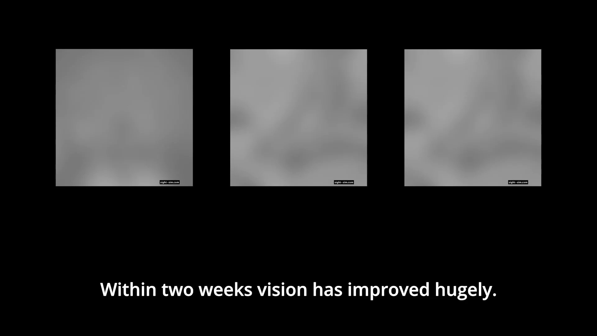 cvisim's tweet card. Milestones Version 1 Captions