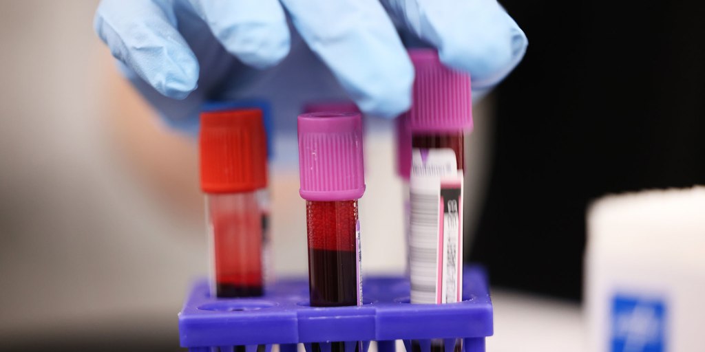 NBCNews's tweet card. A ransomware attack led to 17 blood drives being canceled this weekend.