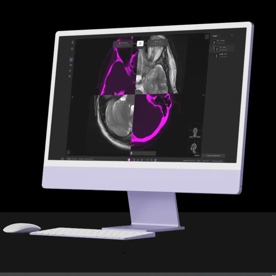 GuidedSolutions's tweet card. Medical Device News by Guided Solutions | Zap Surgical’s ZAP Axon radiosurgery planning system has received 510(k) clearance from the US Food and Drug Administration (FDA), as well as gaining the