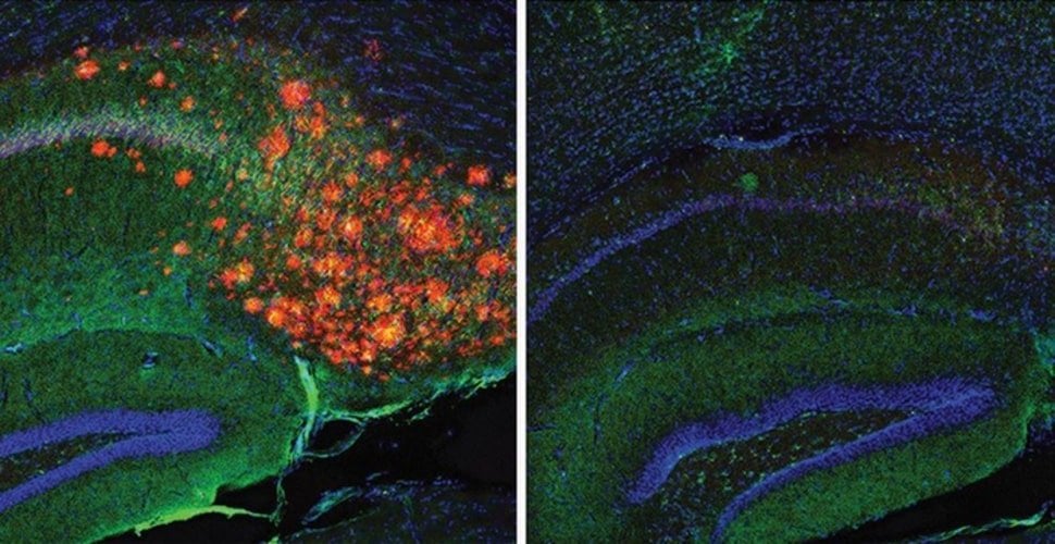NeuroscienceNew's tweet card. A new advanced imaging technique shows how cholesterol regulates the production of Alzheimer's associated amyloid beta proteins in astrocytes.