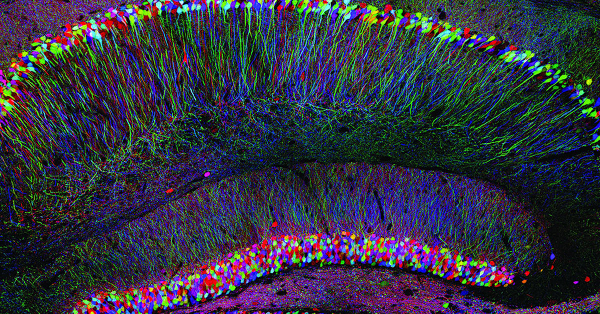 Sicong_T's tweet card. The prospect of mind uploading, and by extension, living long after death is enticing, but is it too good to be true?