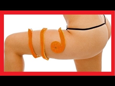 healthusias's tweet card. Cellulite Removal | How to Get Rid of Cellulite Fast | Best Cellulite...