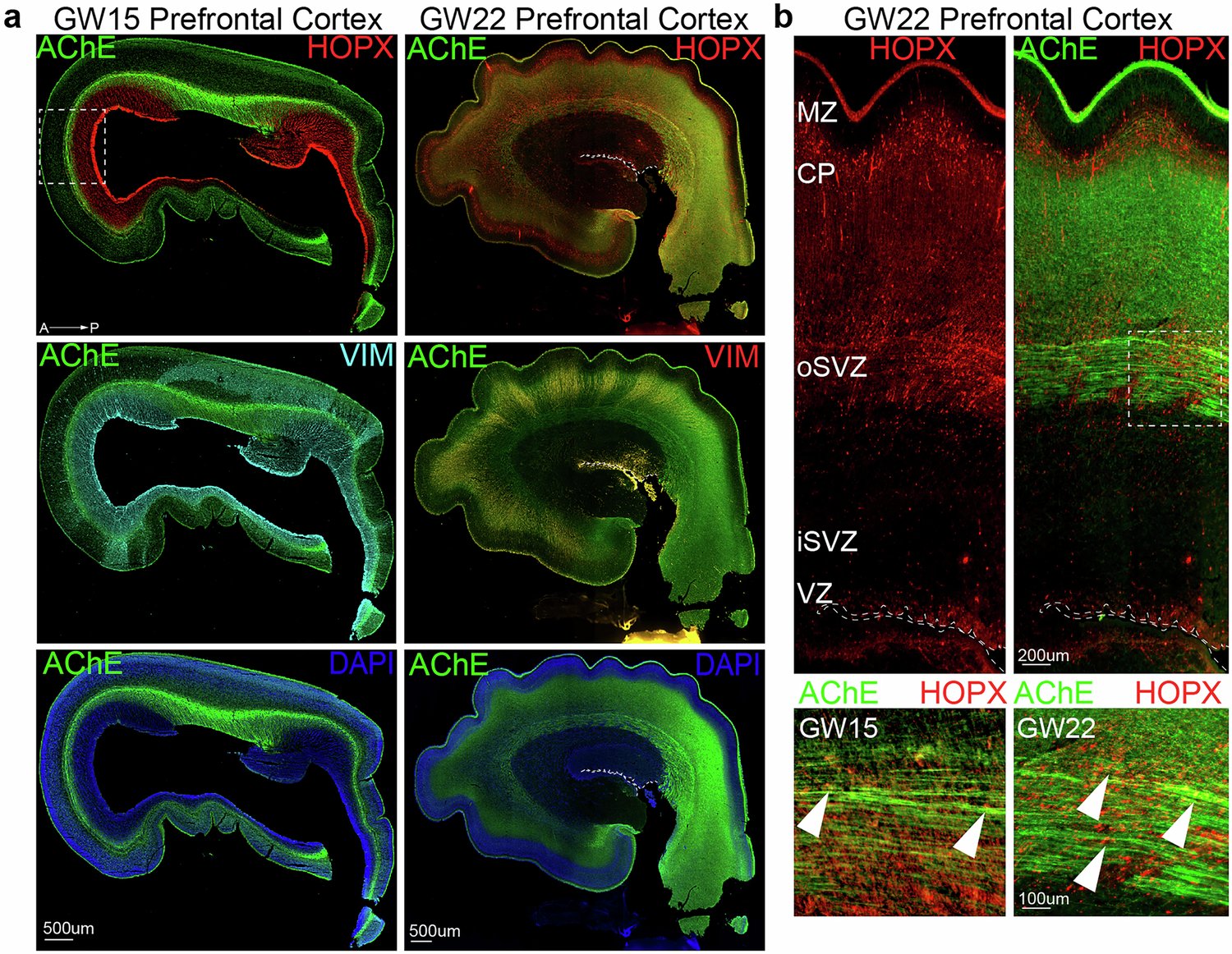 tmturkee's tweet card. Nature Communications - The role of nicotinic acetylcholine receptors in human cortical development remains largely unexplored. Here authors investigate CHRNA7 and CHRFAM7A, uncovering their...