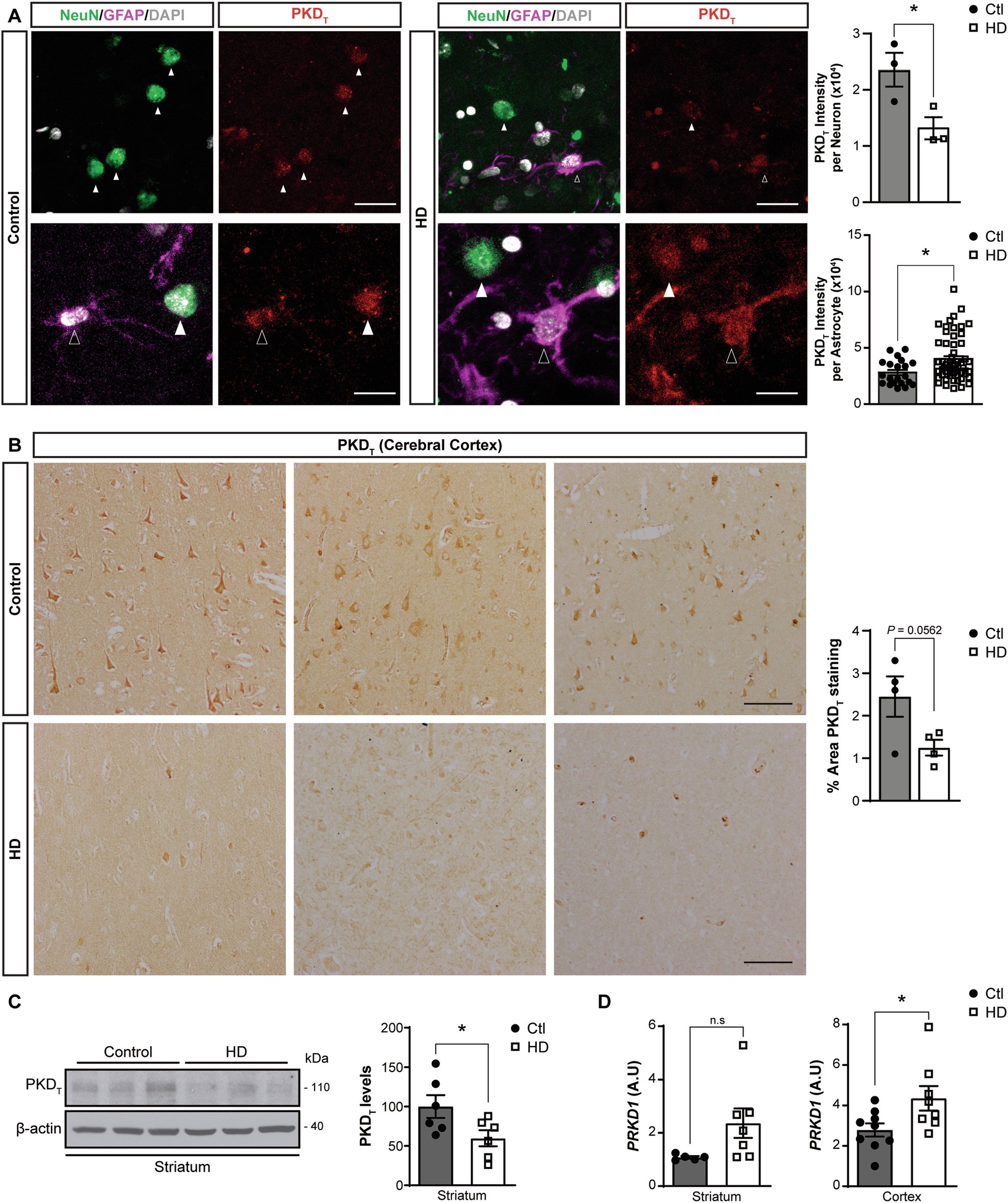 JJLucasLab's tweet card. Cell Death & Disease - Down-regulation of neuroprotective protein kinase D in Huntington´s disease