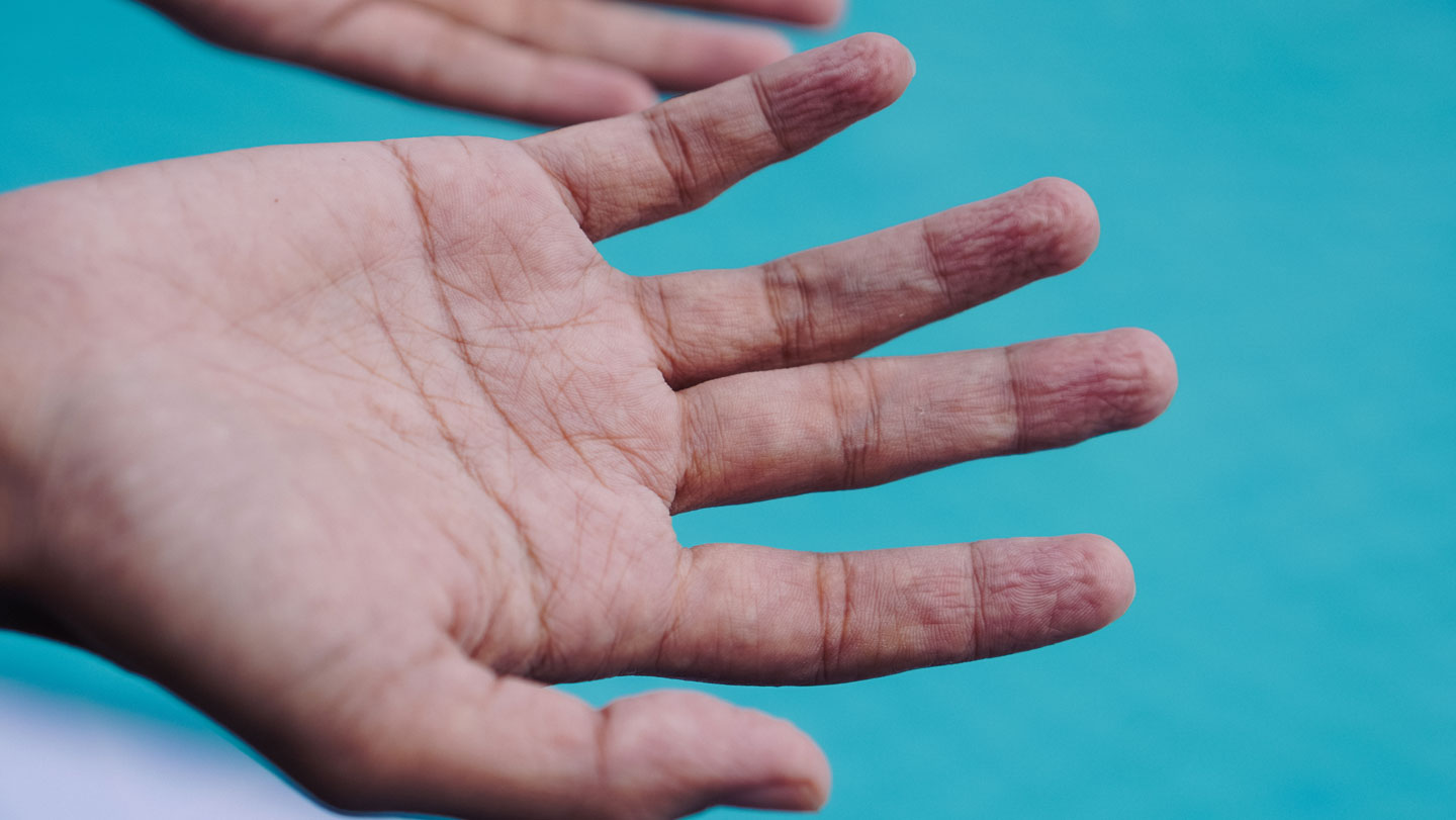 macroschema's tweet card. Pruney fingertips aren't swollen sponges — the wrinkles actually come from blood vessels constricting and pulling skin inward.