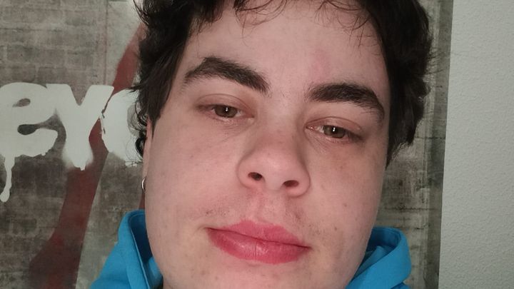 telephonebuzzy's tweet card. My name is Noah, I'm 28 years old transgender man living in Portugal and I need your help. … Noah Pessoa needs your support for Donate for Noah's Top Surgery!