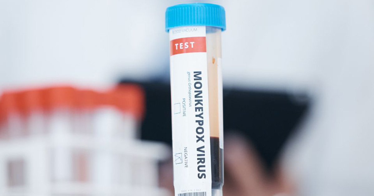 WEHI_research's tweet card. In response to the 2022 global outbreak of the monkeypox virus (MPXV), researchers have harnessed cutting-edge genetic technology to develop Australia’s first-of-its-kind tool for the detection of...