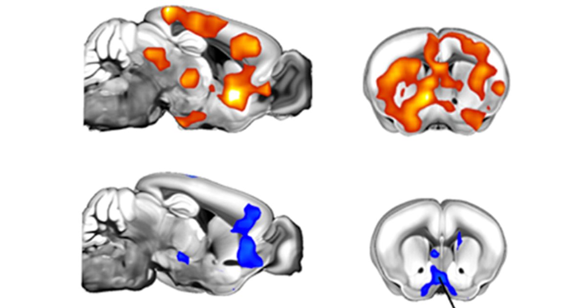 Gozzi_Ale's tweet card. Patterns of brain connectivity shift during puberty in people with deletion of the 22q11.2 chromosomal region.