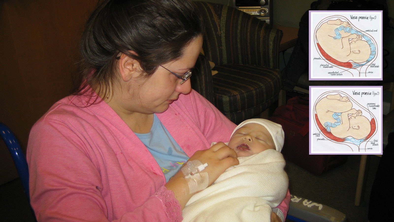 JDHPhotoBlog's tweet card. Save 150+ Babies Per Year by Routine Screening for Vasa Praevia Risk Groups