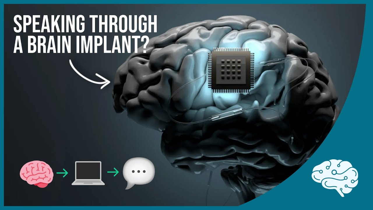 BlackrockNeuro_'s tweet card. Brain Implant Restores Speech to Paralyzed Man
