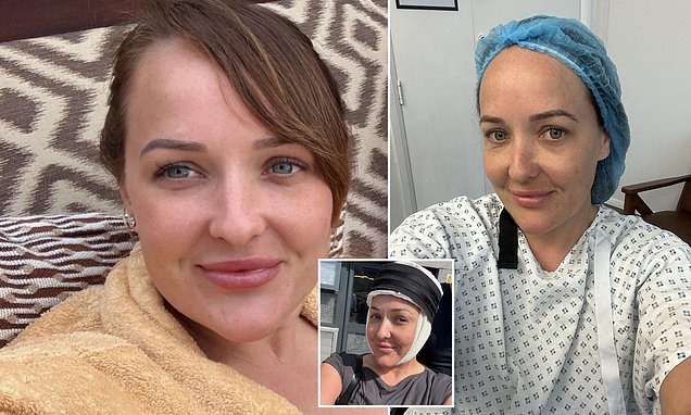 Kennedy__News's tweet card. Chloe Walker, from Hornchurch, Essex, felt so self-conscious about her hairline that she spent £5,000 on surgery to reduce her forehead.
