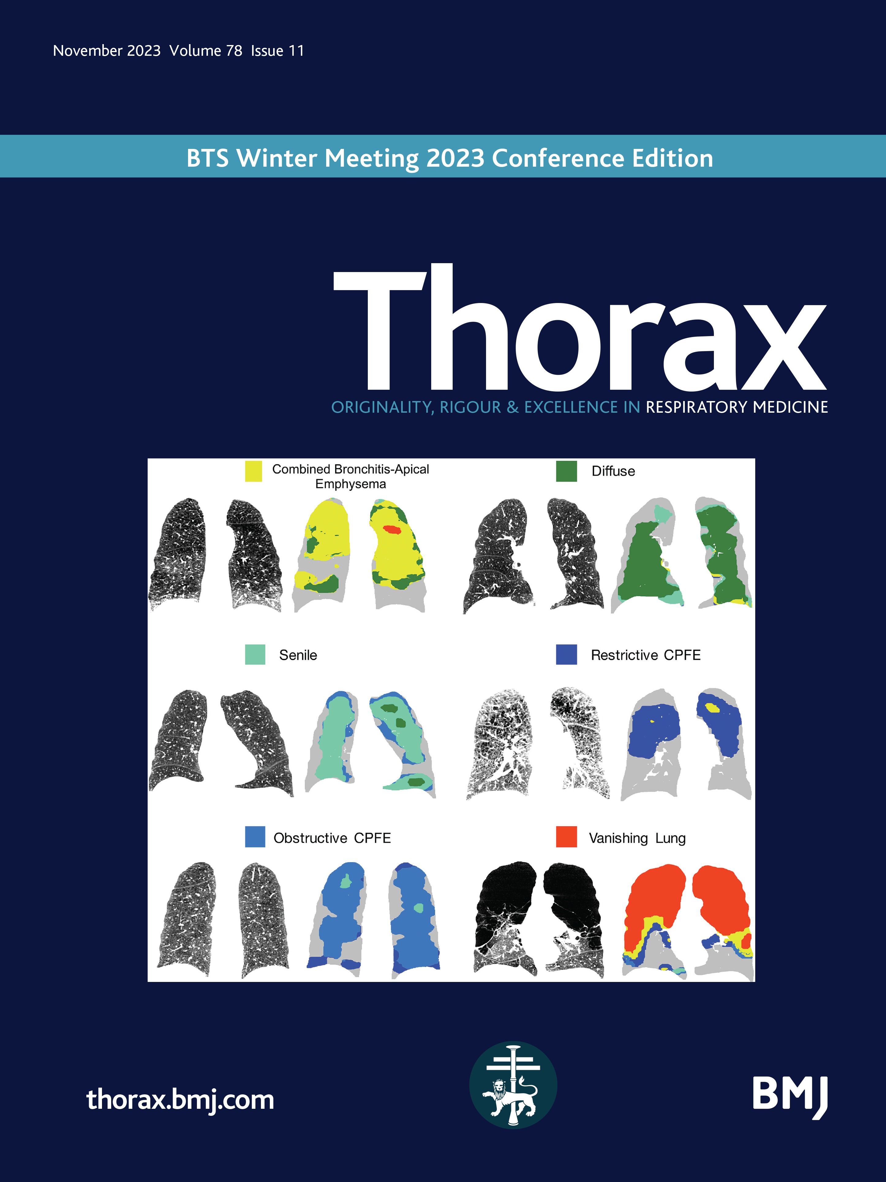 BowyerCressida's tweet card. Background Although 1 billion people live in informal (slum) settlements, the consequences for respiratory health of living in these settlements remain largely unknown. This study investigated...
