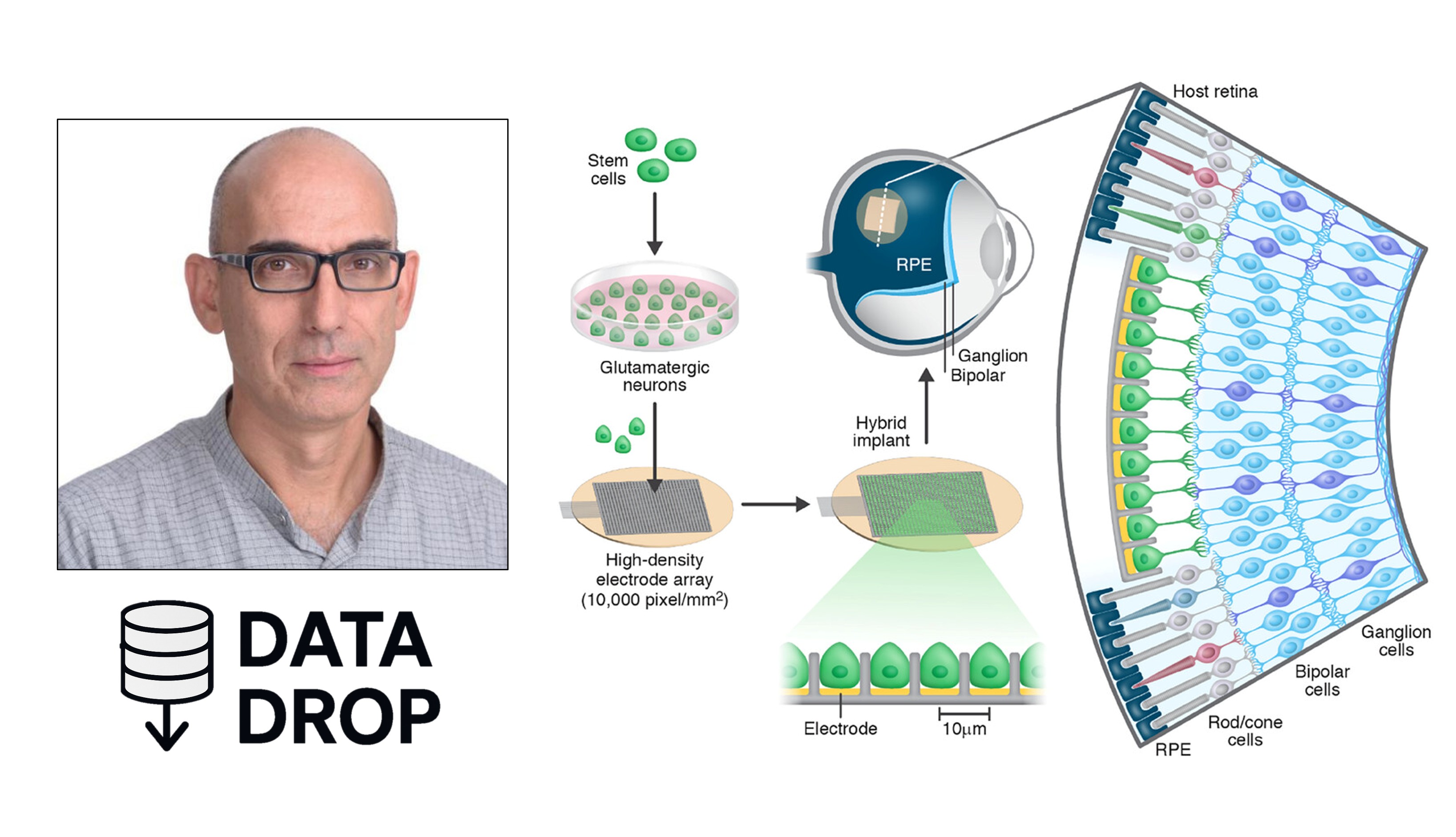 bionicvisionorg's tweet card. In a new Advanced Functional Materials paper, Prof. Yossi Mandel and colleagues unveiled a hybrid retinal prosthesis that fuses living neurons with a high-density electrode array. By nestling human...