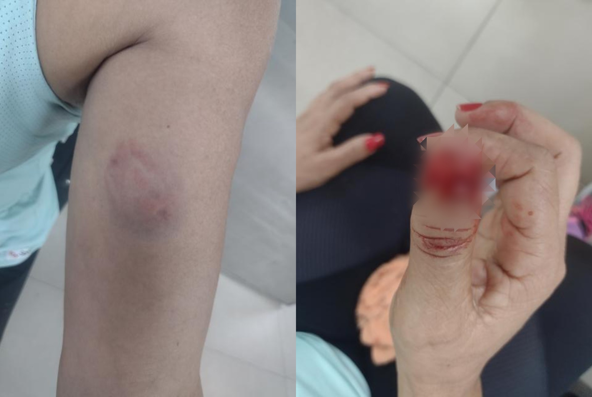 g1roraima's tweet card. Confusão entre aluna e instrutora teve socos, arranhões e mordidas. Nenhuma das duas negou agressões, segundo a Polícia Militar.