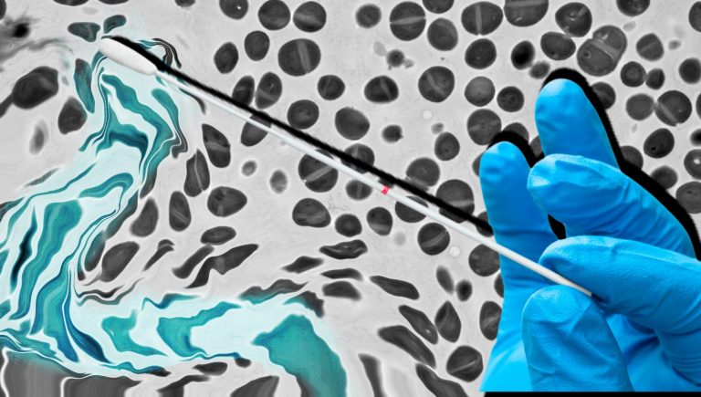 patrickc's tweet card. Stanford University scientists' findings in mice could translate into a radical, needle-free vaccination approach that would also eliminate reactions including fever, swelling and pain.