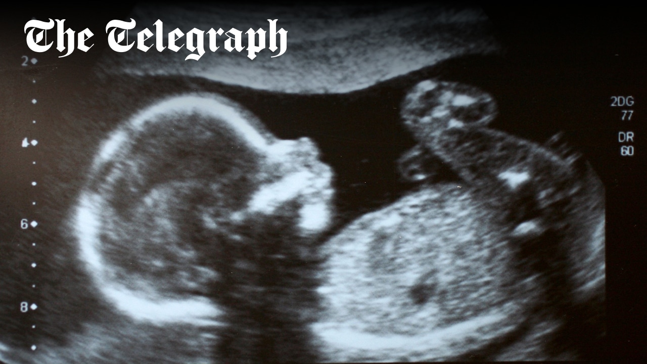 PamGosalMSP's tweet card. Campaigners alarmed by expert review’s advice against explicit ban on gender selection