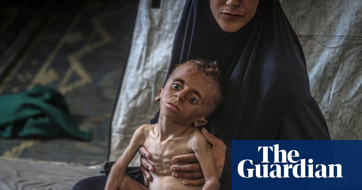 theAliceRoberts's tweet card. Charity says number of people needing care for malnutrition has quadrupled and blames Israeli ‘policy of starvation’