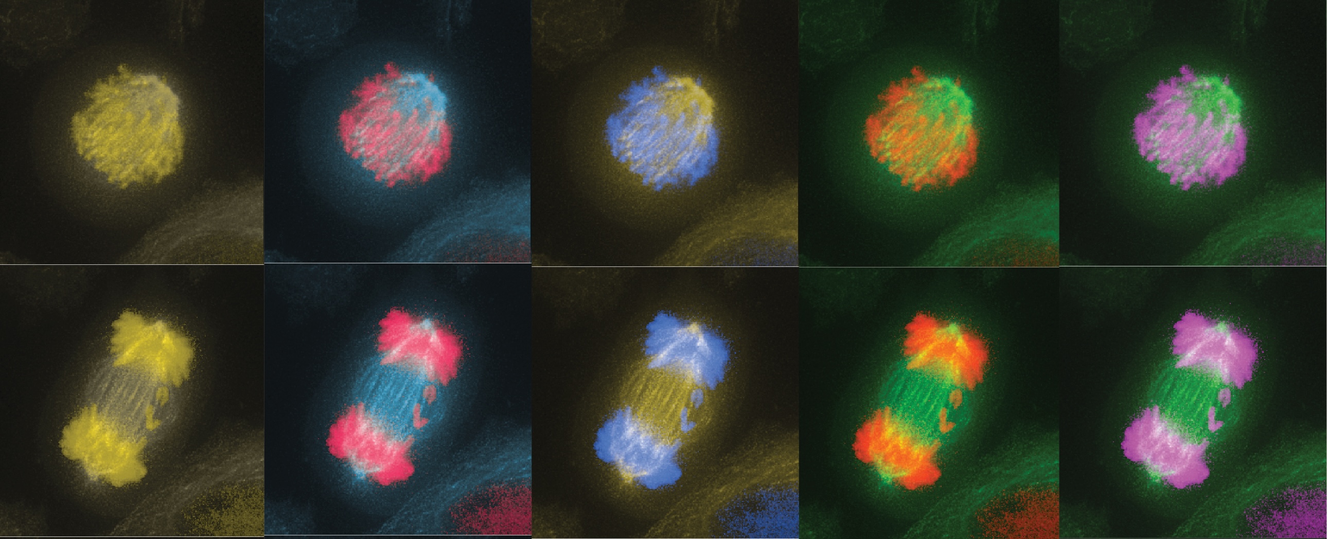 ELogarinho's tweet card. Aneuploidy is a hallmark of cancer and developmental disorders such as Down syndrome. Understanding how cells accomplish faithful chromosome segregation and how chromosomal instability (CIN) impacts …