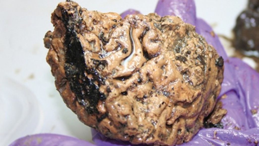 BrainSplain's tweet card. Britain's Oldest Surviving Human Brain Was Preserved In Mud For 2,600 Years