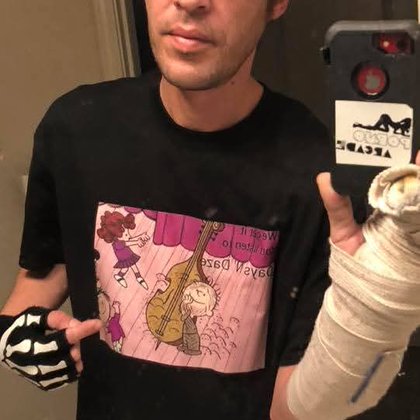 Tweet card summary image