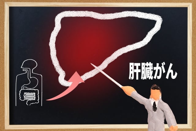 koumonka_doctor's tweet card. ワクチン接種後のターボ癌については以前ブログで書きました。 『ワクチン接種後のターボ癌』ワクチン接種後の癌については以前ブログで書きました。  『ワクチン接種…