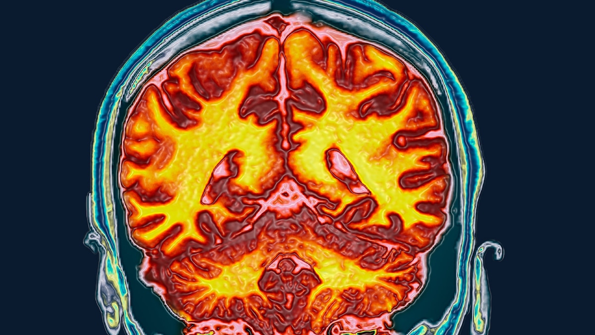 ej_rise's tweet card. Studies show the menstrual cycle changes certain brain regions. But they don’t reveal whether that’s connected to emotional fluctuations.