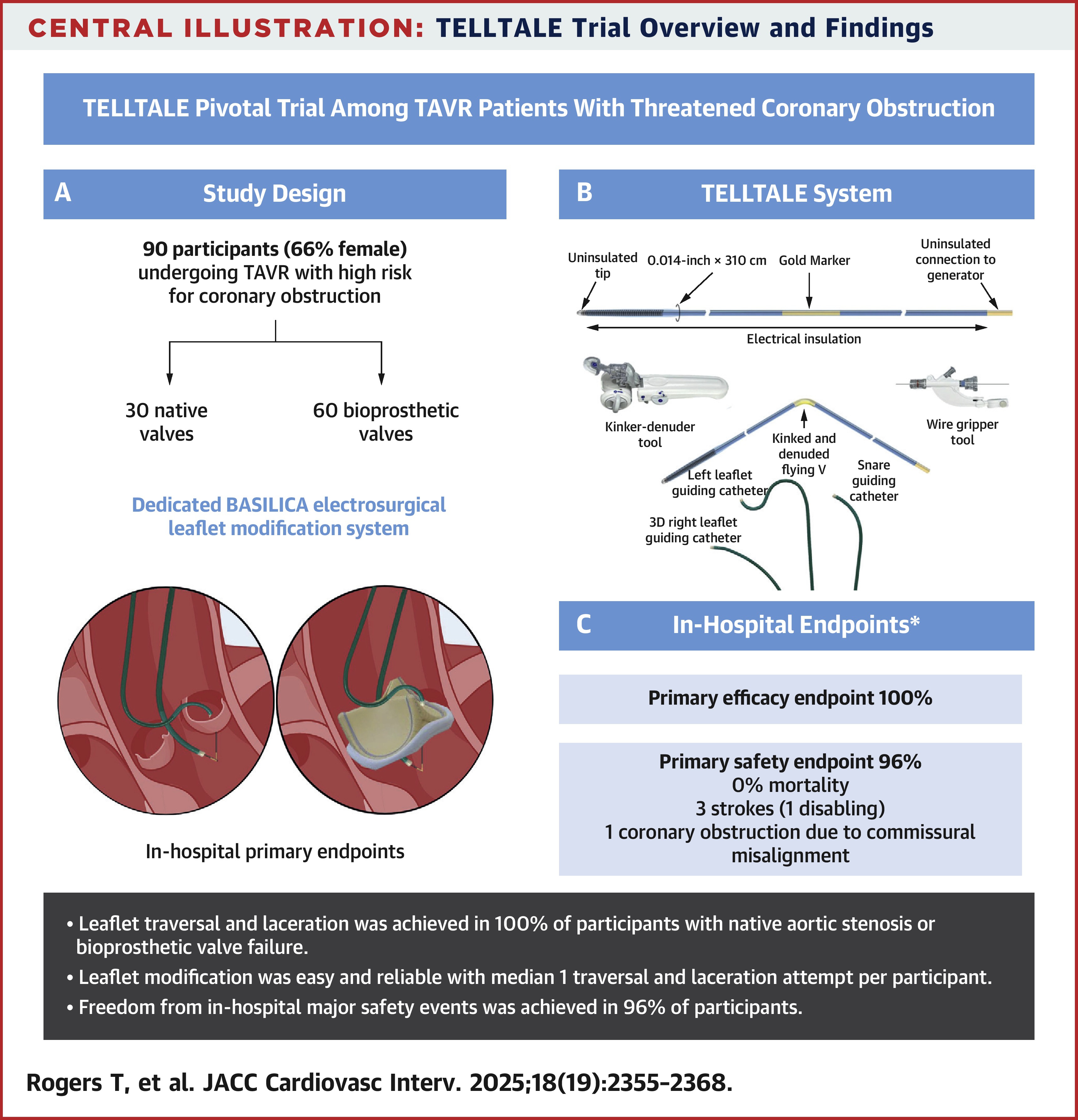 CathElectroSurg's tweet card. Electrosurgical Leaflet Modification to Prevent Coronary Obstruction During Transcatheter Aortic...