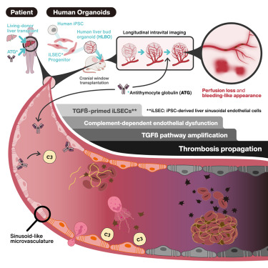 CellRepMed's tweet card. Kawamura et al. model antithymocyte globulin (ATG)-induced microvasculopathy in vivo using human iPSC-derived vascularized liver organoids with intravital imaging. ATG provokes a human LSEC-specific,...