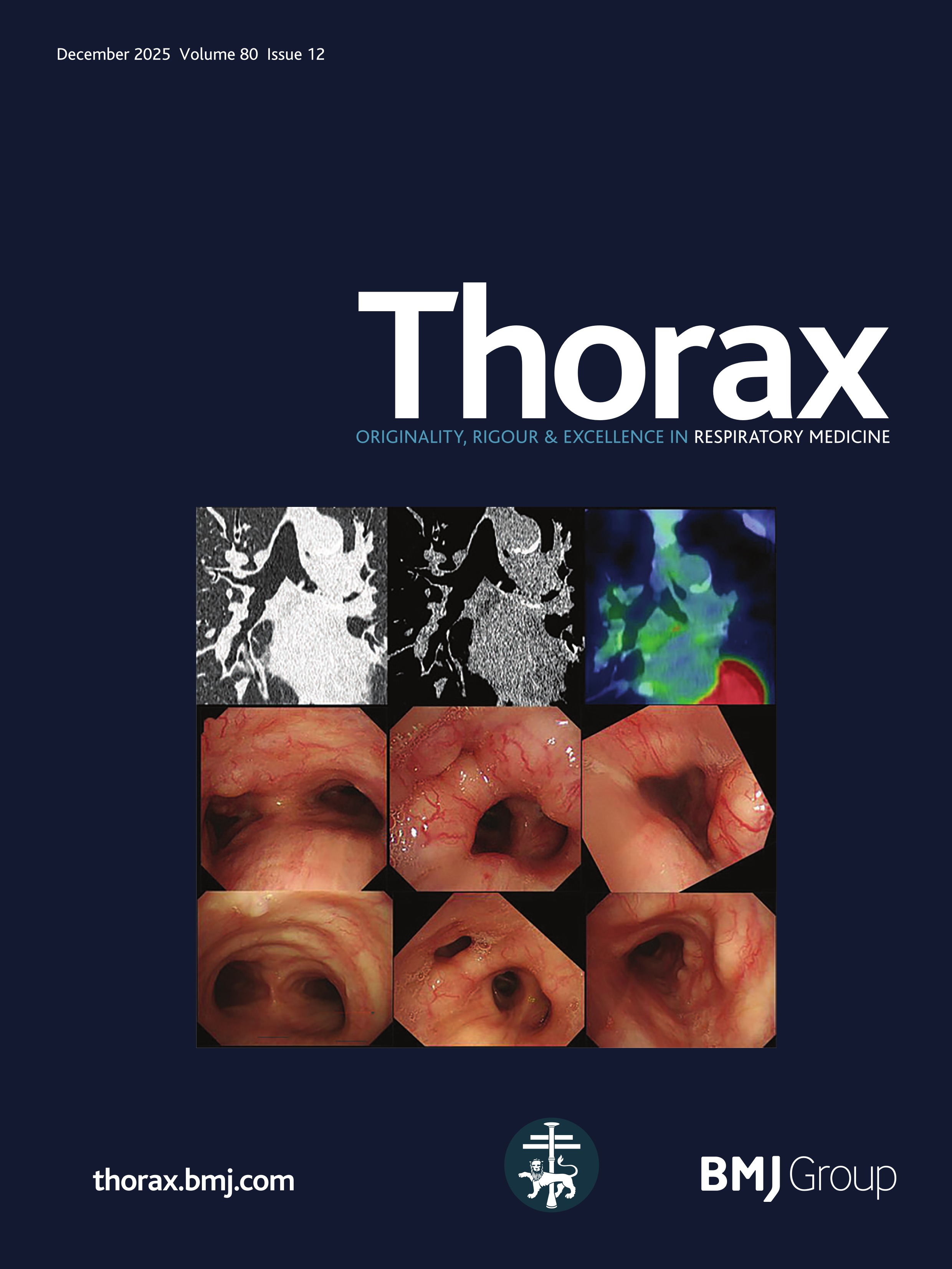 patrick_goodley's tweet card. Background Numerous lung cancer risk prediction models have been developed and validated worldwide. It is imperative to offer a comprehensive overview and comparative analysis of their performances....